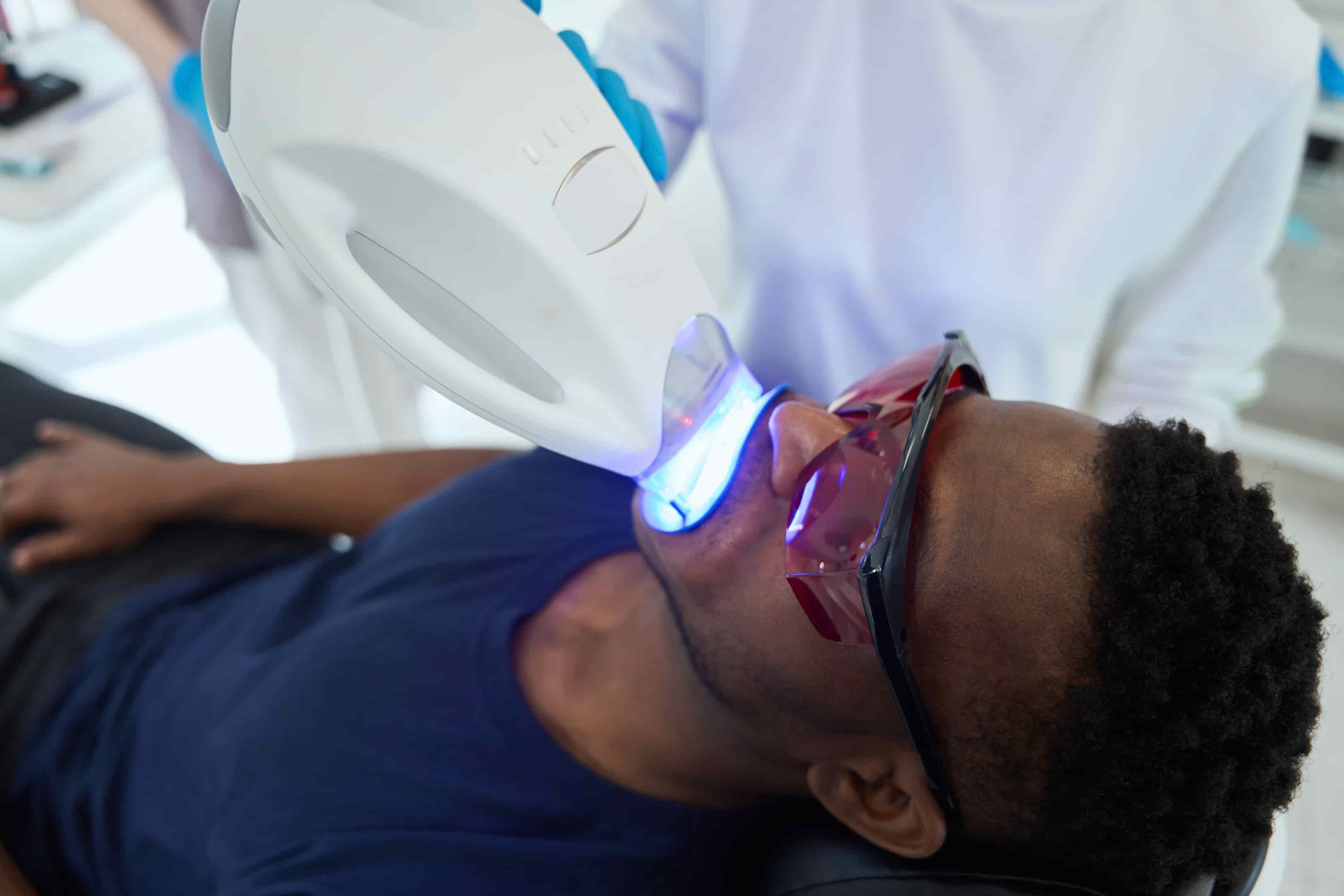 Professional Teeth Whitening vs. At-Home: What’s Safer?